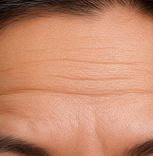 Fine Lines / Ageing